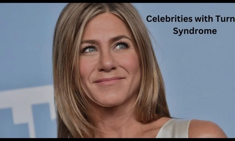 Celebrities with Turner Syndrome